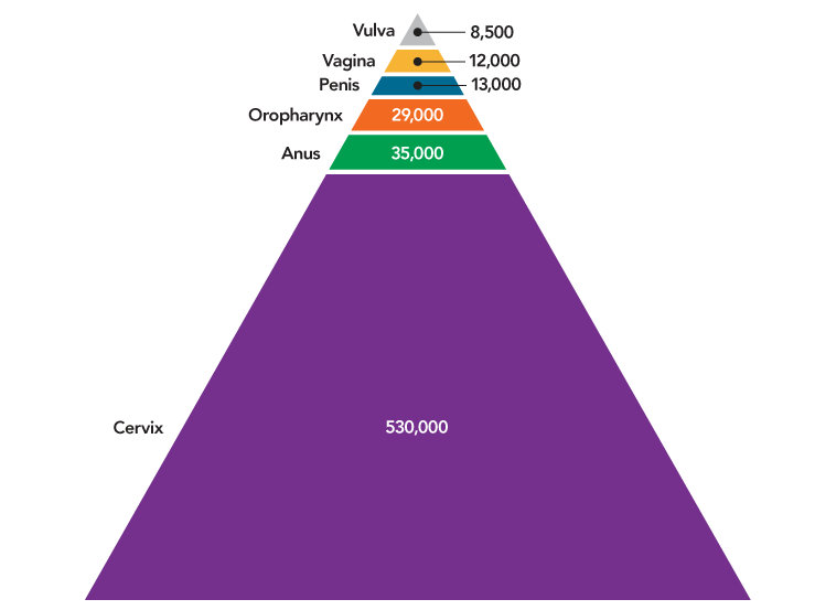 This stacked pyramid shows the numbers of HPV cancers worldwide each year by site.
                        Numbers of cancers are: vulva: 8,500; vagina: 12,000; penis: 13,000; oropharynx: 29,000; anus: 35,000; and cervix: 530,000.